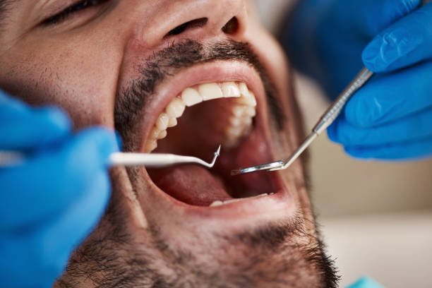 Best Emergency Treatment for Dental Infections or Abscesses in Glen Dale, WV