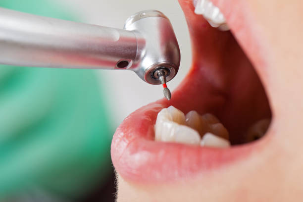 Best Emergency Gum Treatment in Glen Dale, WV